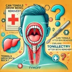 can tonsils grow back after being removed? - tymoff